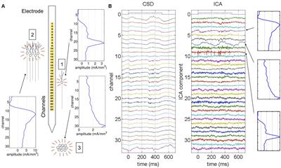 Theta Oscillations Alternate With High Amplitude Neocortical Population Within Synchronized States